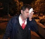 /haber/turkiye-de-gazetecilere-yonelik-siddet-genellikle-cezasizlikla-sonuclanir-208468
